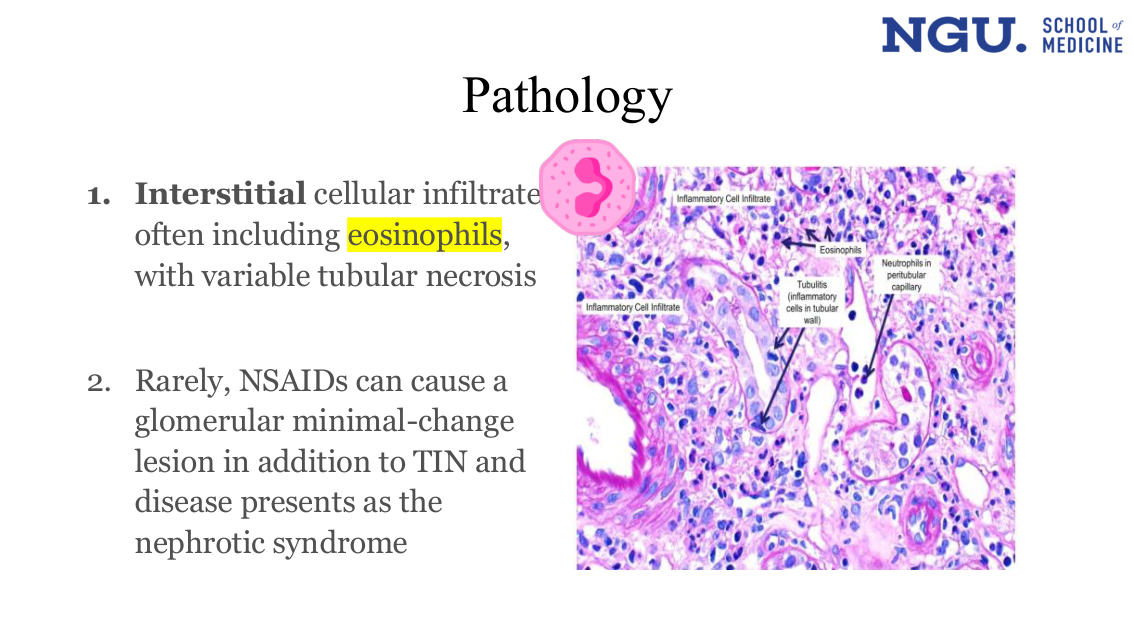 slide11.png (Pathology histology micrograph)