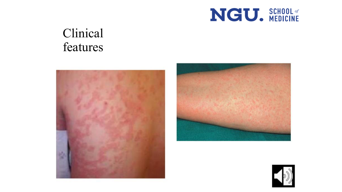 slide13.png (Clinical features — patient photographs)