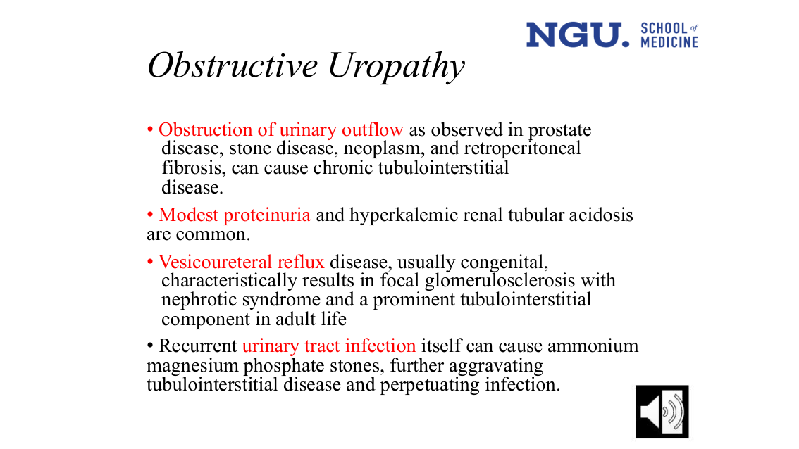 Obstructive uropathy slide (slide 36)