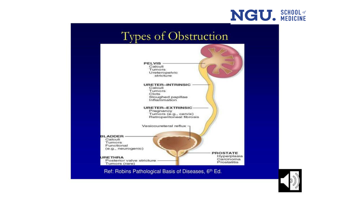 Types of Obstruction — sites and causes (slide 37)